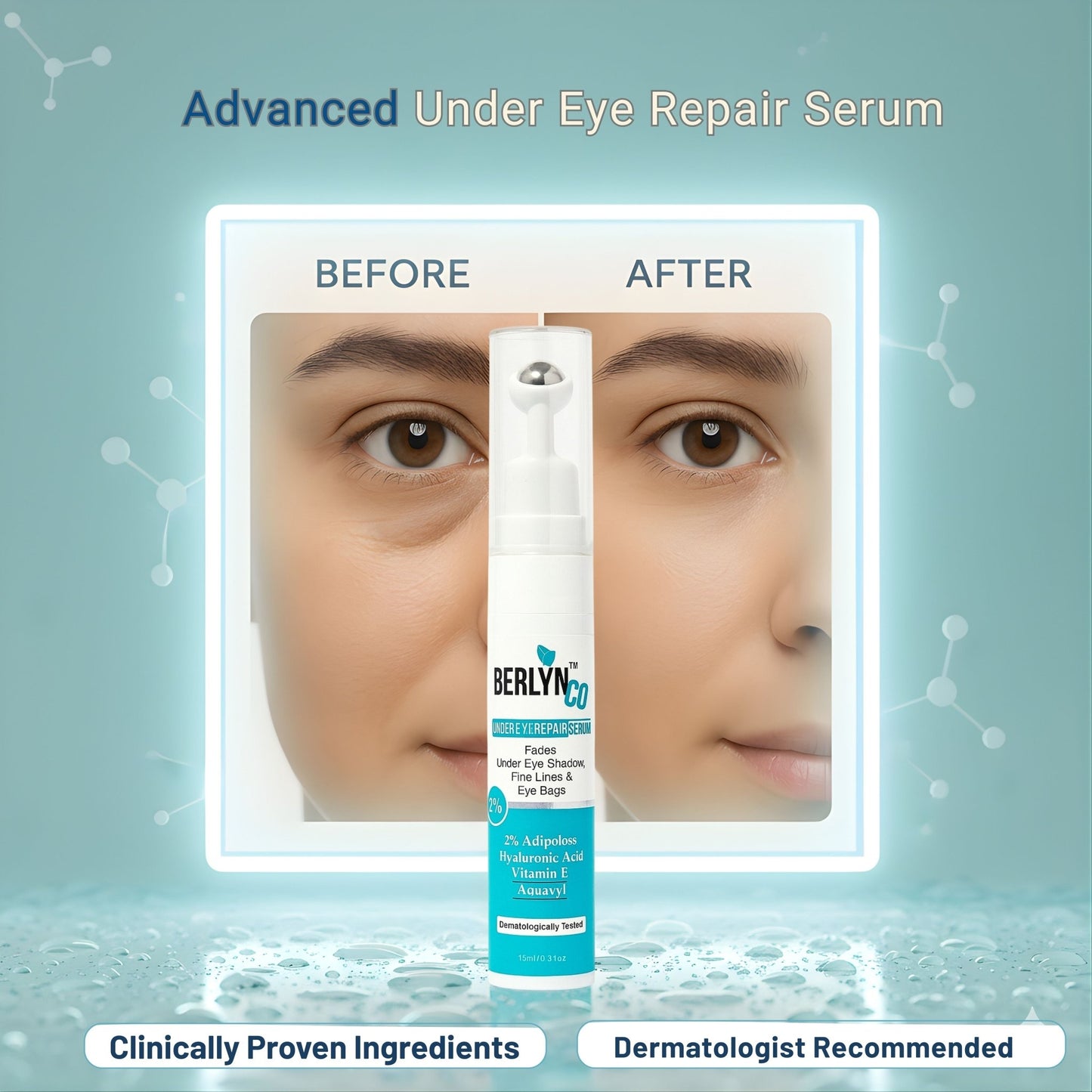 Berlynco Advanced Under Eye Repair Serum | Clinically Proven | Reduces Puffiness, Dark Circles & Fine Lines | Dermatologist Tested 15 ml roll on bottle - Berlynco