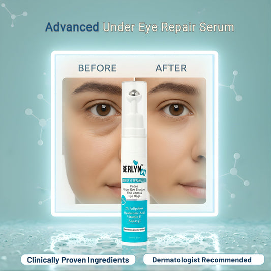 Berlynco Advanced Under Eye Repair Serum | Clinically Proven | Reduces Puffiness, Dark Circles & Fine Lines | Dermatologist Tested 15 ml roll on bottle - Berlynco