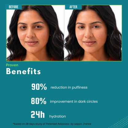 Berlynco Advanced Under Eye Repair Serum for Puffiness, Dark Circles & Fine Lines | 15 ml roll on - Berlynco