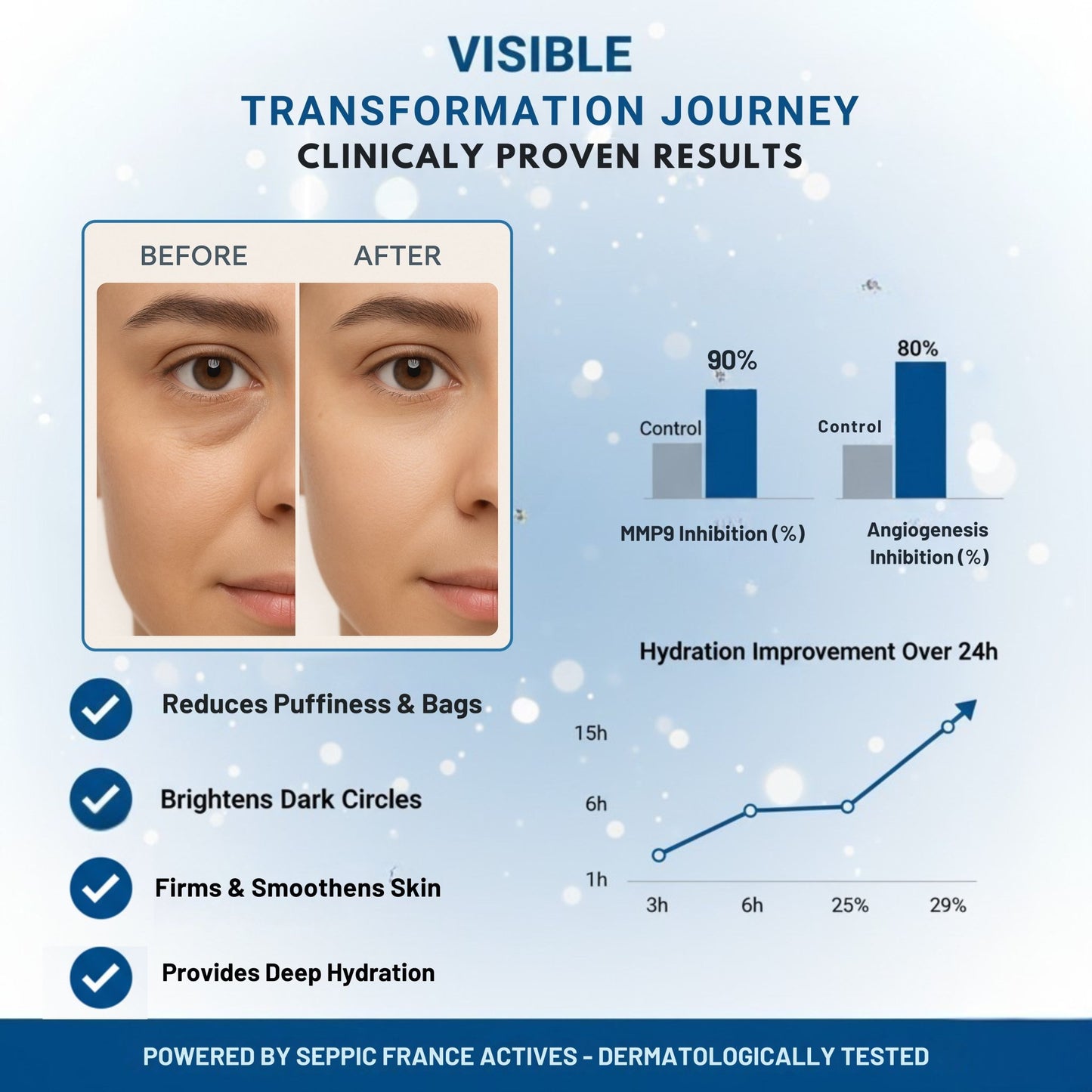 Berlynco Advanced Under Eye Repair Serum | Clinically Proven | Reduces Puffiness, Dark Circles & Fine Lines | Dermatologist Tested 15 ml roll on bottle - Berlynco