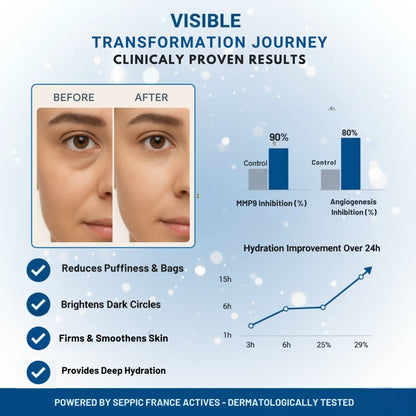 Berlynco Advanced Under Eye Repair Serum | Clinically Proven | Reduces Puffiness, Dark Circles & Fine Lines | Dermatologist Tested 15 ml roll on bottle - Berlynco